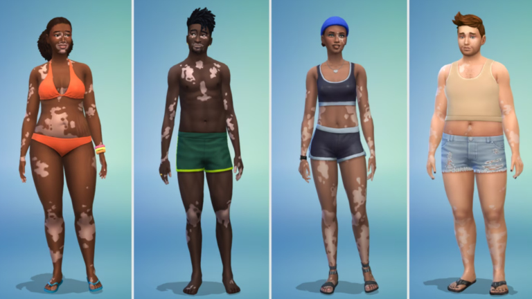 Vier unterschiedliche Figuren aus Die Sims 4 mit Vitiligo.