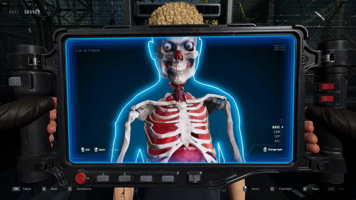 Ingame-Röntgenscan zeigt Skelett und Organe eines Infizierten auf Tablet-Display – medizinische Diagnose-Mechanik in düsterem Survival-Spiel.